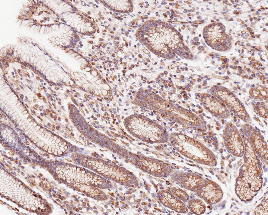 Immunohistochemical analysis of paraffin-embedded human stomach tissue with Rabbit anti-CLASP1 antibody (ET7109-31) at 1/1,000 dilution.<br />
<br />
The section was pre-treated using heat mediated antigen retrieval with Tris-EDTA buffer (pH 9.0) for 20 minutes. The tissues were blocked in 1% BSA for 20 minutes at room temperature, washed with ddH2O and PBS, and then probed with the primary antibody (ET7109-31) at 1/1,000 dilution for 1 hour at room temperature. The detection was performed using an HRP conjugated compact polymer system. DAB was used as the chromogen. Tissues were counterstained with hematoxylin and mounted with DPX.