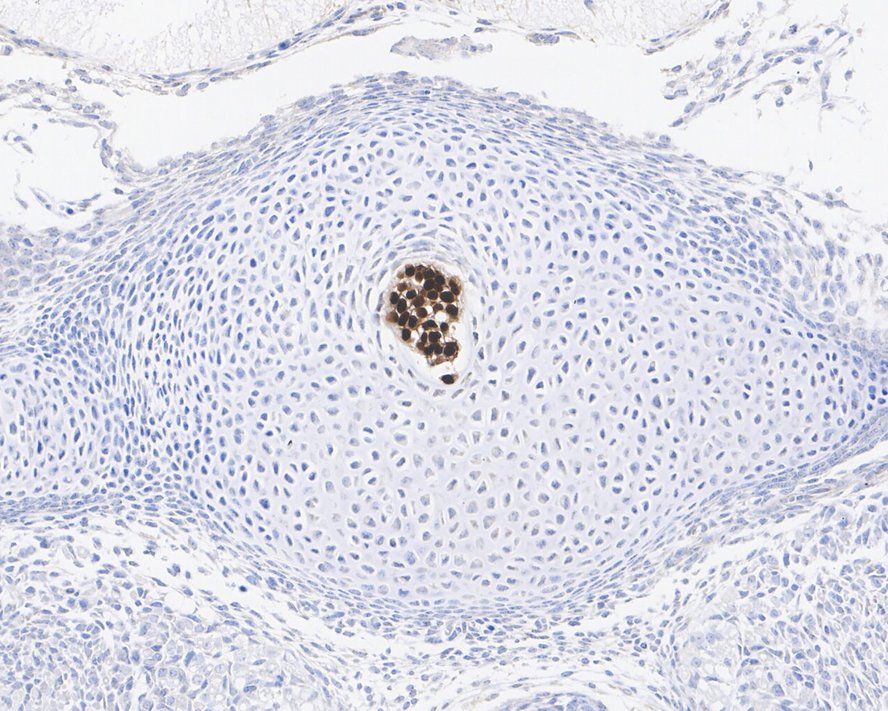 Immunohistochemical analysis of paraffin-embedded mouse E14.5 embryo tissue using anti-Brachyury / Bry antibody. The section was pre-treated using heat mediated antigen retrieval with Tris-EDTA buffer (pH 8.0-8.4) for 20 minutes.The tissues were blocked in 5% BSA for 30 minutes at room temperature, washed with ddH2O and PBS, and then probed with the primary antibody (ET7109-35, 1/200) for 30 minutes at room temperature. The detection was performed using an HRP conjugated compact polymer system. DAB was used as the chromogen. Tissues were counterstained with hematoxylin and mounted with DPX.