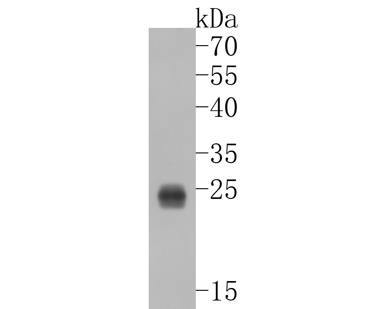Western blot analysis of Ndufs4 on zebrafish tissue lysates. Proteins were transferred to a PVDF membrane and blocked with 5% BSA in PBS for 1 hour at room temperature. The primary antibody (ET7109-37, 1/500) was used in 5% BSA at room temperature for 2 hours. Goat Anti-Rabbit IgG - HRP Secondary Antibody (HA1001) at 1:5,000 dilution was used for 1 hour at room temperature.