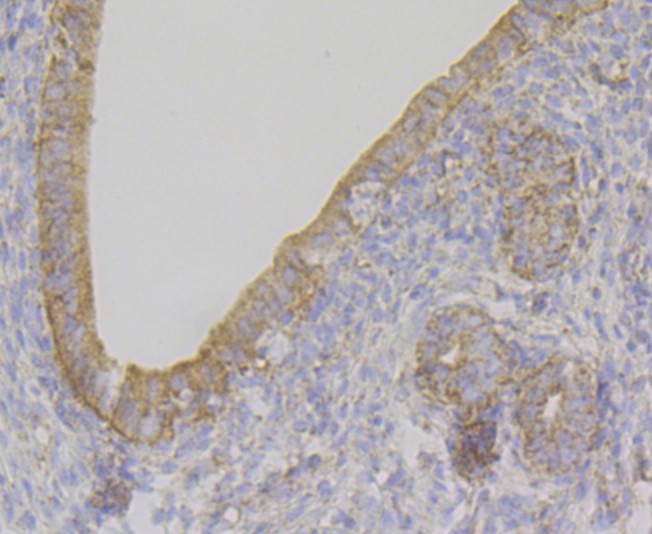 Immunohistochemical analysis of paraffin-embedded rat uterus tissue using anti-Ndufs4 antibody. The section was pre-treated using heat mediated antigen retrieval with Tris-EDTA buffer (pH 8.0-8.4) for 20 minutes. The tissues were blocked in 5% BSA for 30 minutes at room temperature, washed with ddH2O and PBS, and then probed with the antibody (ET7109-37) at 1/100 dilution, for 30 minutes at room temperature and detected using an HRP conjugated compact polymer system. DAB was used as the chrogen. Counter stained with hematoxylin and mounted with DPX.