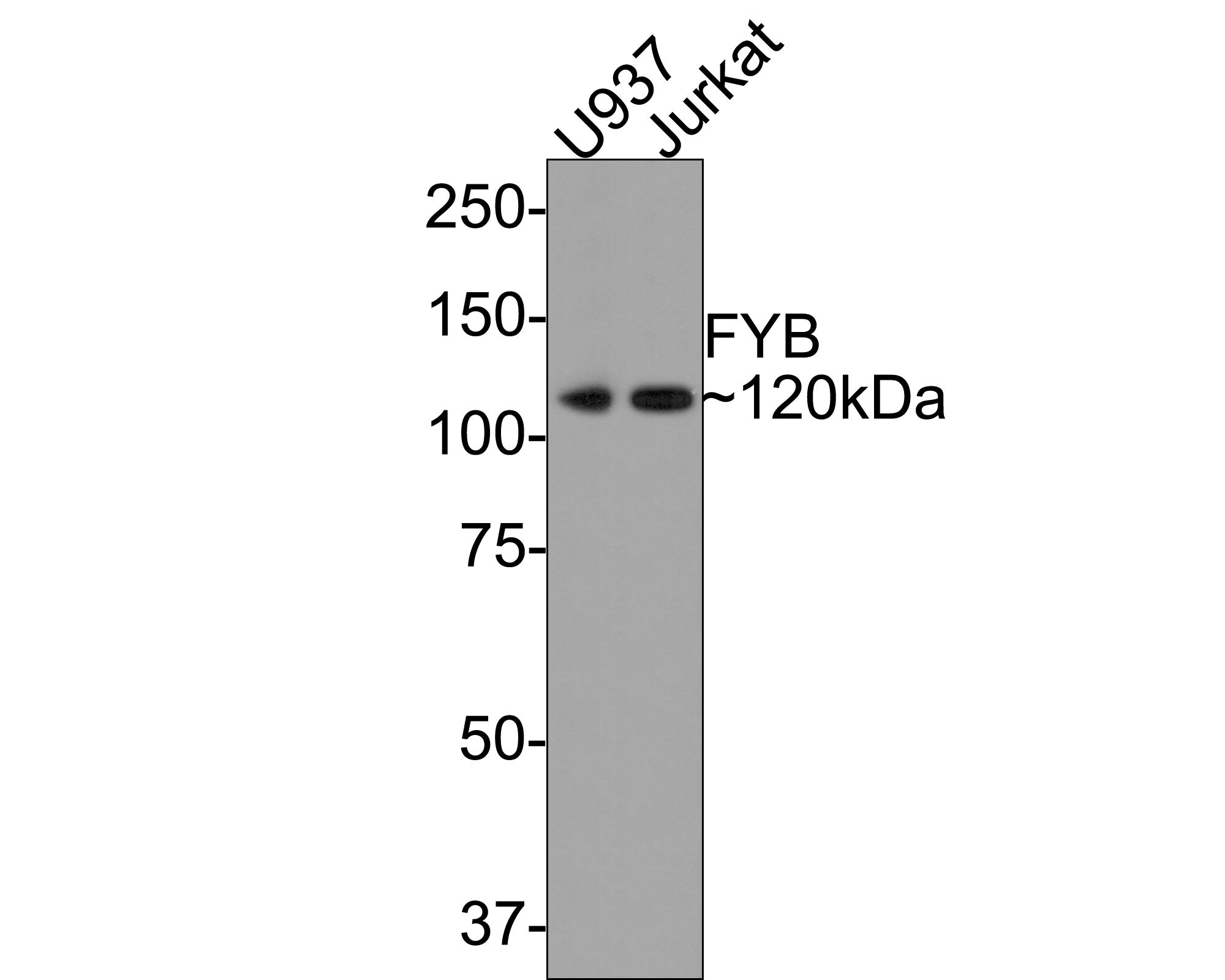 Western blot analysis of FYB on different lysates with Rabbit anti-FYB antibody (ET7109-38) at 1/500 dilution.<br />
<br />
Lane 1: U937 cell lysate<br />
Lane 2: Jurkat cell lysate<br />
<br />
Lysates/proteins at 10 µg/Lane.<br />
<br />
Predicted band size: 85 kDa<br />
Observed band size: 120 kDa<br />
<br />
Exposure time: 2 minutes;<br />
<br />
8% SDS-PAGE gel.<br />
<br />
Proteins were transferred to a PVDF membrane and blocked with 5% NFDM/TBST for 1 hour at room temperature. The primary antibody (ET7109-38) at 1/500 dilution was used in 5% NFDM/TBST at room temperature for 2 hours. Goat Anti-Rabbit IgG - HRP Secondary Antibody (HA1001) at 1:300,000 dilution was used for 1 hour at room temperature.