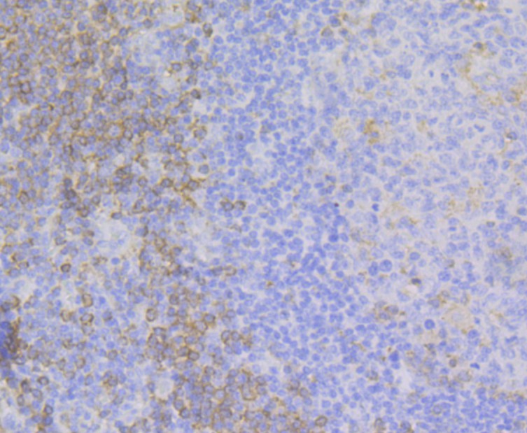 Immunohistochemical analysis of paraffin-embedded human appendix tissue using anti-FYB antibody. The section was pre-treated using heat mediated antigen retrieval with Tris-EDTA buffer (pH 8.0-8.4) for 20 minutes. The tissues were blocked in 5% BSA for 30 minutes at room temperature, washed with ddH2O and PBS, and then probed with the antibody (ET7109-38) at 1/200 dilution, for 30 minutes at room temperature and detected using an HRP conjugated compact polymer system. DAB was used as the chrogen. Counter stained with hematoxylin and mounted with DPX.