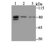 Western blot analysis of MARK3 on different lysates. Proteins were transferred to a PVDF membrane and blocked with 5% BSA in PBS for 1 hour at room temperature. The primary antibody was used at a 1:500 dilution in 5% BSA at room temperature for 2 hours. Goat Anti-Rabbit IgG - HRP Secondary Antibody (HA1001) at 1:5,000 dilution was used for 1 hour at room temperature.<br />
Positive control: <br />
Lane 1: rat brain tissue lysate<br />
Lane 2: A431 cell lysate<br />
Lane 3: 293 cell lysate