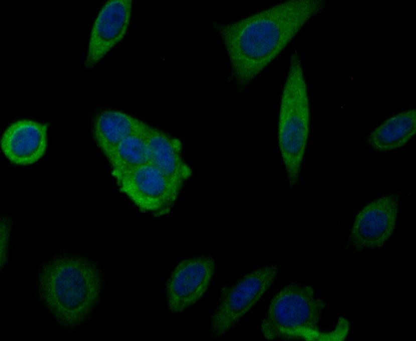 Immunocytochemistry staining MARK3 in MCF-7 cells (green). Formalin fixed cells were permeabilized with 0.1% Triton X-100 in TBS for 10 minutes at room temperature and blocked with 1% Blocker BSA for 15 minutes at room temperature. Cells were probed with MARK3 monoclonal antibody at a dilution of 1:100 for 1 hour at room temperature, washed with PBS. Alexa Fluorc™ 488 Goat anti-Rabbit IgG was used as the secondary antibody at 1/100 dilution. The nuclear counter stain is DAPI (blue).