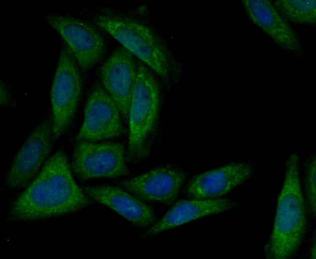 Immunocytochemistry staining MARK3 in SiHa cells (green). Formalin fixed cells were permeabilized with 0.1% Triton X-100 in TBS for 10 minutes at room temperature and blocked with 1% Blocker BSA for 15 minutes at room temperature. Cells were probed with MARK3 monoclonal antibody at a dilution of 1:50 for 1 hour at room temperature, washed with PBS. Alexa Fluorc™ 488 Goat anti-Rabbit IgG was used as the secondary antibody at 1/100 dilution. The nuclear counter stain is DAPI (blue).
