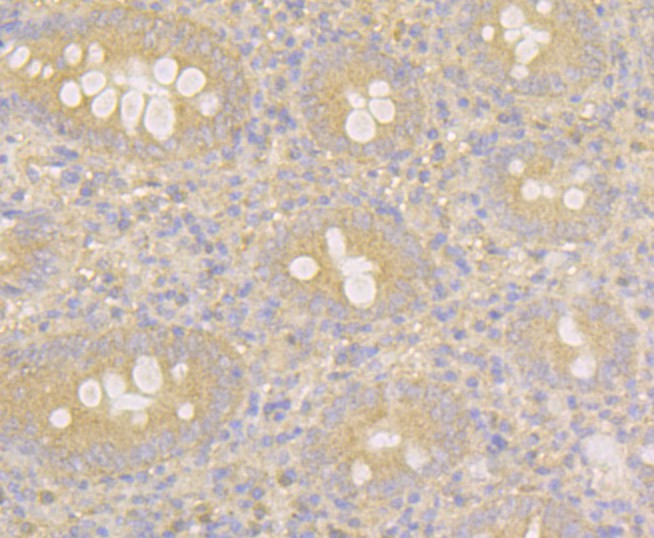 Immunohistochemical analysis of paraffin-embedded human appendix tissue using anti-MARK3 antibody. The section was pre-treated using heat mediated antigen retrieval with Tris-EDTA buffer (pH 8.0-8.4) for 20 minutes. The tissues were blocked in 5% BSA for 30 minutes at room temperature, washed with ddH2O and PBS, and then probed with the antibody (ET7109-39) at 1/100 dilution, for 30 minutes at room temperature and detected using an HRP conjugated compact polymer system. DAB was used as the chrogen. Counter stained with hematoxylin and mounted with DPX.