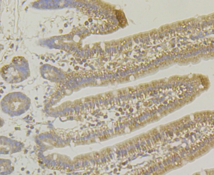 Immunohistochemical analysis of paraffin-embedded mouse small intestine tissue using anti-MARK3 antibody. The section was pre-treated using heat mediated antigen retrieval with Tris-EDTA buffer (pH 8.0-8.4) for 20 minutes. The tissues were blocked in 5% BSA for 30 minutes at room temperature, washed with ddH2O and PBS, and then probed with the antibody (ET7109-39) at 1/100 dilution, for 30 minutes at room temperature and detected using an HRP conjugated compact polymer system. DAB was used as the chrogen. Counter stained with hematoxylin and mounted with DPX.