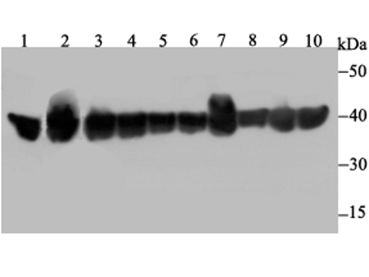 Western blot analysis of PPP1CB on different lysates. Proteins were transferred to a PVDF membrane and blocked with 5% BSA in PBS for 1 hour at room temperature. The primary antibody was used at a 1:500 dilution in 5% BSA at room temperature for 2 hours. Goat Anti-Rabbit IgG - HRP Secondary Antibody (HA1001) at 1:5,000 dilution was used for 1 hour at room temperature.<br />
Positive control: <br />
Lane 1: Mouse skeletal muscle tissue lysate<br />
Lane 2: Rat brain tissue lysate<br />
Lane 3: A431 cell lysate<br />
Lane 4: SH-SY-5Y cell lysate<br />
Lane 5: SiHa cell lysate<br />
Lane 6: 293 cell lysate<br />
Lane 7: Hela cell lysate<br />
Lane 8: PC-3M cell lysate<br />
Lane 9: HepG2 cell lysate<br />
Lane 10: A549 cell lysate