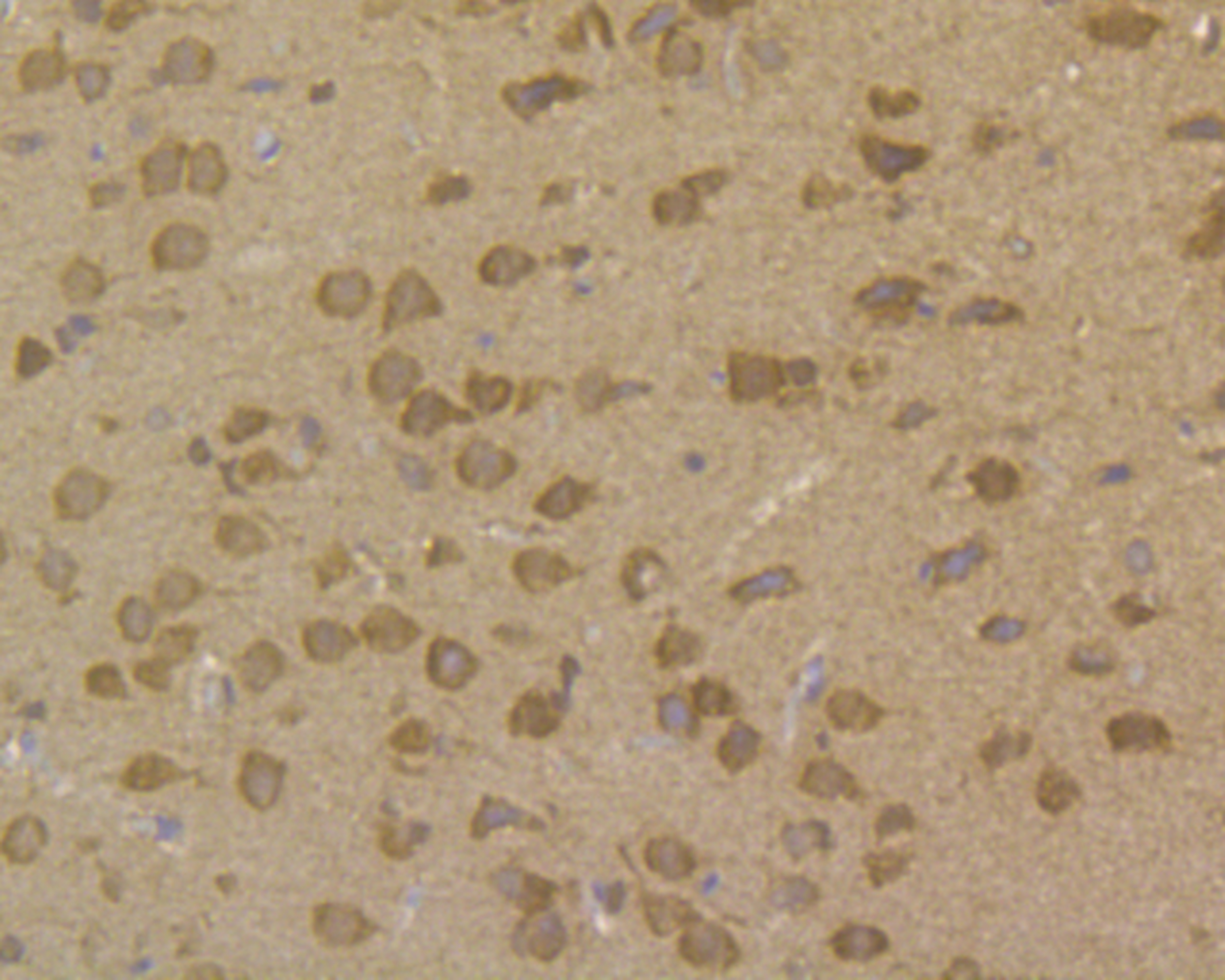 Immunohistochemical analysis of paraffin-embedded rat brain tissue using anti-PPP1CB antibody. The section was pre-treated using heat mediated antigen retrieval with sodium citrate buffer (pH 6.0) for 20 mins.The tissues were blocked in 5% BSA for 30 minutes at room temperature, washed with ddH2O and PBS, and then probed with the antibody (ET7109-40) at 1/200 dilution, for 30 minutes at room temperature and detected using an HRP conjugated compact polymer system. DAB was used as the chrogen. Counter stained with hematoxylin and mounted with DPX.