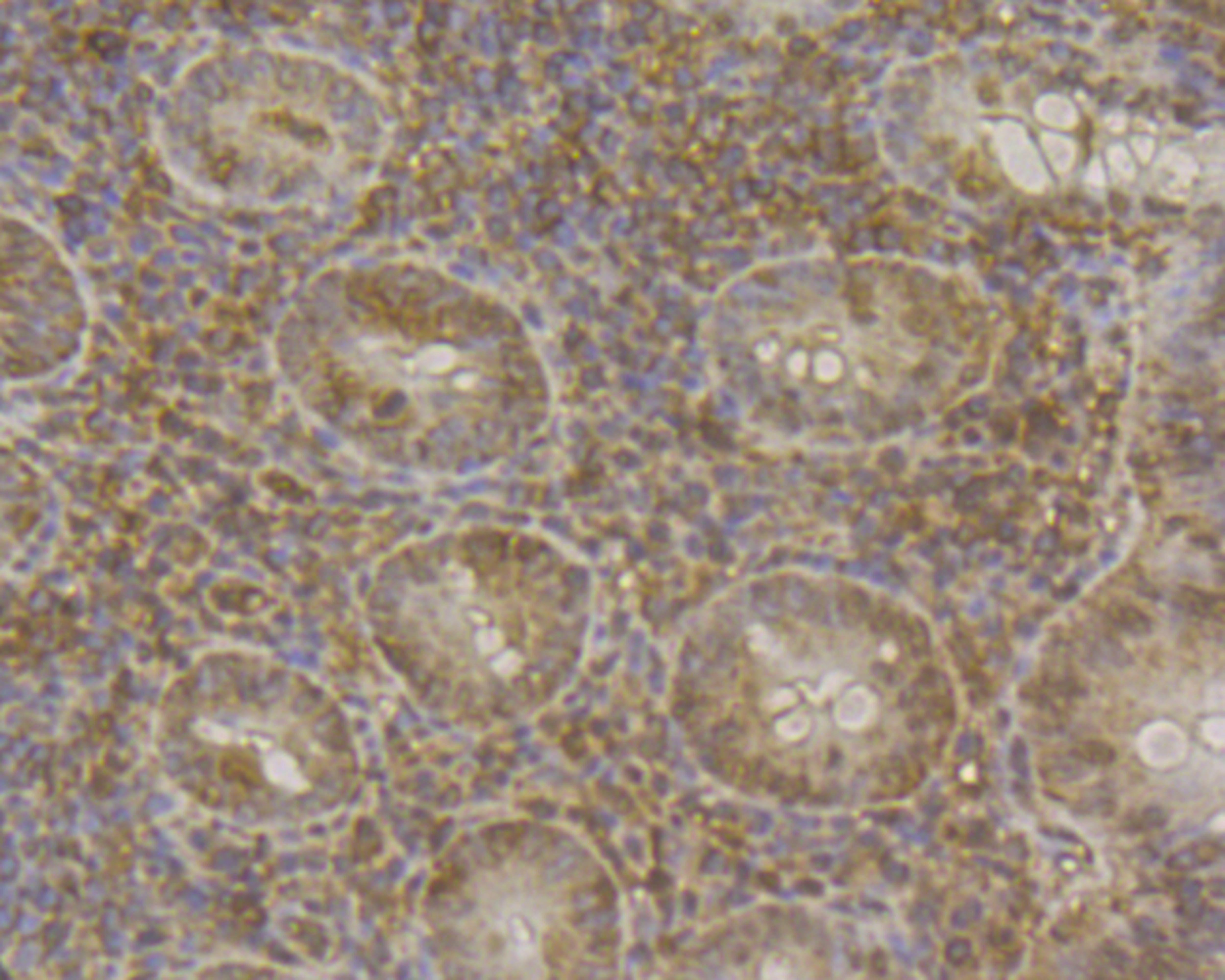 Immunohistochemical analysis of paraffin-embedded human appendix tissue using anti-PPP1CB antibody. The section was pre-treated using heat mediated antigen retrieval with sodium citrate buffer (pH 6.0) for 20 mins.The tissues were blocked in 5% BSA for 30 minutes at room temperature, washed with ddH2O and PBS, and then probed with the antibody (ET7109-40) at 1/200 dilution, for 30 minutes at room temperature and detected using an HRP conjugated compact polymer system. DAB was used as the chrogen. Counter stained with hematoxylin and mounted with DPX.