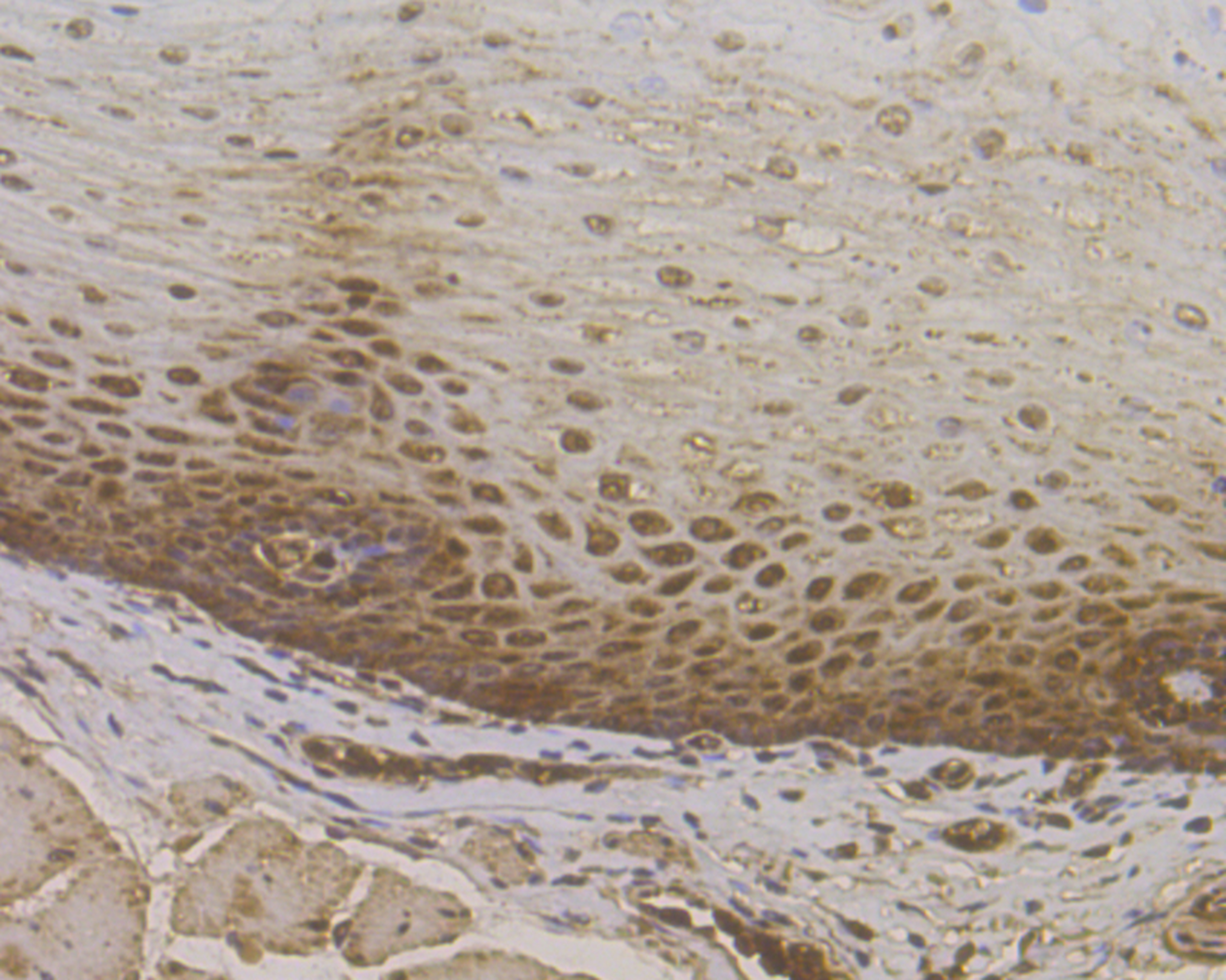 Immunohistochemical analysis of paraffin-embedded human esophagus tissue using anti-PPP1CB antibody. The section was pre-treated using heat mediated antigen retrieval with sodium citrate buffer (pH 6.0) for 20 mins.The tissues were blocked in 5% BSA for 30 minutes at room temperature, washed with ddH2O and PBS, and then probed with the antibody (ET7109-40) at 1/200 dilution, for 30 minutes at room temperature and detected using an HRP conjugated compact polymer system. DAB was used as the chrogen. Counter stained with hematoxylin and mounted with DPX.
