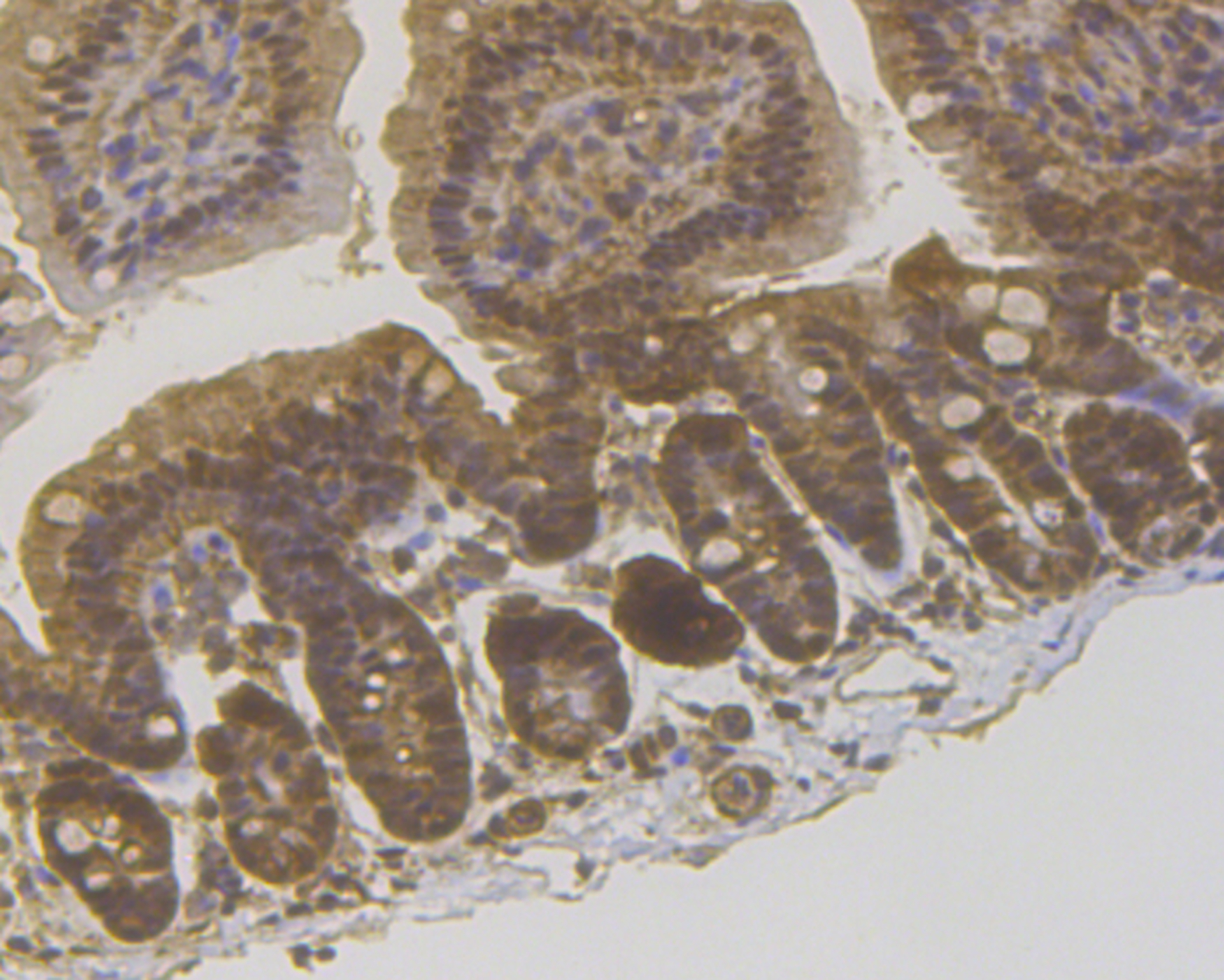 Immunohistochemical analysis of paraffin-embedded mouse colon tissue using anti-PPP1CB antibody. The section was pre-treated using heat mediated antigen retrieval with sodium citrate buffer (pH 6.0) for 20 mins.The tissues were blocked in 5% BSA for 30 minutes at room temperature, washed with ddH2O and PBS, and then probed with the antibody (ET7109-40) at 1/200 dilution, for 30 minutes at room temperature and detected using an HRP conjugated compact polymer system. DAB was used as the chrogen. Counter stained with hematoxylin and mounted with DPX.