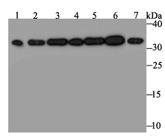 Western blot analysis of RPA32/RPA2 on different lysates. Proteins were transferred to a PVDF membrane and blocked with 5% BSA in PBS for 1 hour at room temperature. The primary antibody was used at a 1:500 dilution in 5% BSA at room temperature for 2 hours. Goat Anti-Rabbit IgG - HRP Secondary Antibody (HA1001) at 1:5,000 dilution was used for 1 hour at room temperature.<br />
Positive control:<br />
Lane 1: Mouse testis tissue lysate<br />
Lane 2: A431 cell lysate<br />
Lane 3: SH-SY-5Y cell lysate<br />
Lane 4: SiHa cell lysate<br />
Lane 5: 293 cell lysate<br />
Lane 6: Hela cell lysate<br />
Lane 7: HepG2 cell lysate