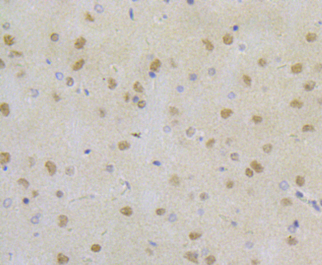 Immunohistochemical analysis of paraffin-embedded rat brain tissue using anti-RPA32/RPA2 antibody. The section was pre-treated using heat mediated antigen retrieval with Tris-EDTA buffer (pH 8.0-8.4) for 20 minutes. The tissues were blocked in 5% BSA for 30 minutes at room temperature, washed with ddH2O and PBS, and then probed with the antibody (ET7109-41) at 1/50 dilution, for 30 minutes at room temperature and detected using an HRP conjugated compact polymer system. DAB was used as the chrogen. Counter stained with hematoxylin and mounted with DPX.