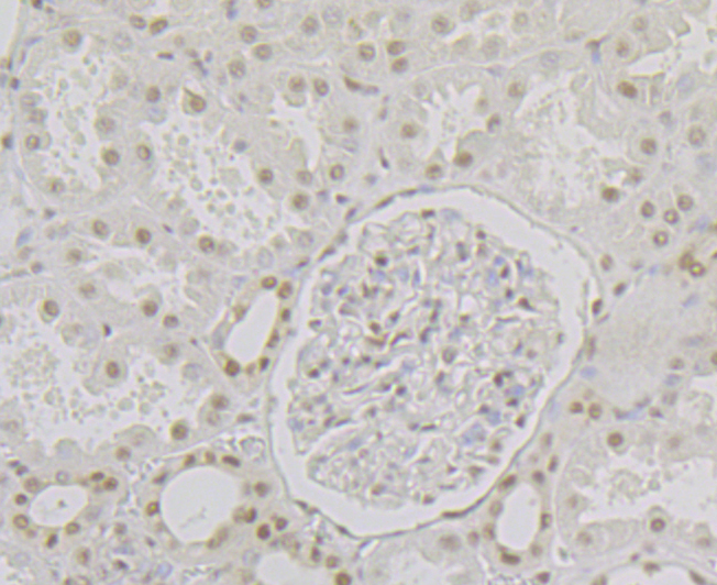 Immunohistochemical analysis of paraffin-embedded human kidney tissue using anti-RPA32/RPA2 antibody. The section was pre-treated using heat mediated antigen retrieval with Tris-EDTA buffer (pH 8.0-8.4) for 20 minutes. The tissues were blocked in 5% BSA for 30 minutes at room temperature, washed with ddH2O and PBS, and then probed with the antibody (ET7109-41) at 1/200 dilution, for 30 minutes at room temperature and detected using an HRP conjugated compact polymer system. DAB was used as the chrogen. Counter stained with hematoxylin and mounted with DPX.