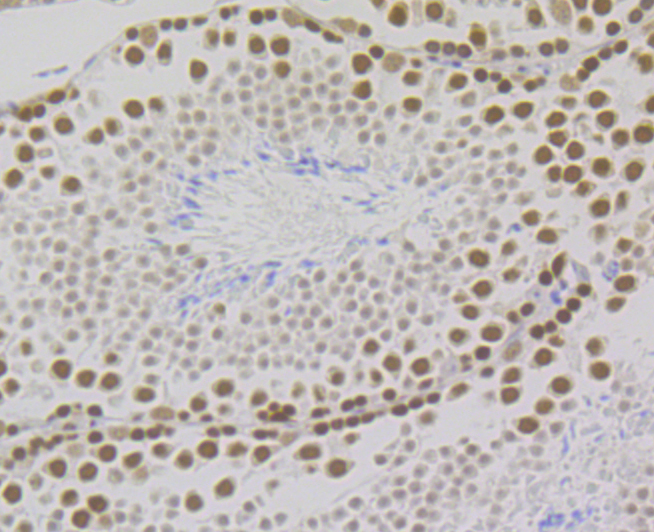Immunohistochemical analysis of paraffin-embedded mouse testis tissue using anti-RPA32/RPA2 antibody. The section was pre-treated using heat mediated antigen retrieval with Tris-EDTA buffer (pH 8.0-8.4) for 20 minutes. The tissues were blocked in 5% BSA for 30 minutes at room temperature, washed with ddH2O and PBS, and then probed with the antibody (ET7109-41) at 1/200 dilution, for 30 minutes at room temperature and detected using an HRP conjugated compact polymer system. DAB was used as the chrogen. Counter stained with hematoxylin and mounted with DPX.