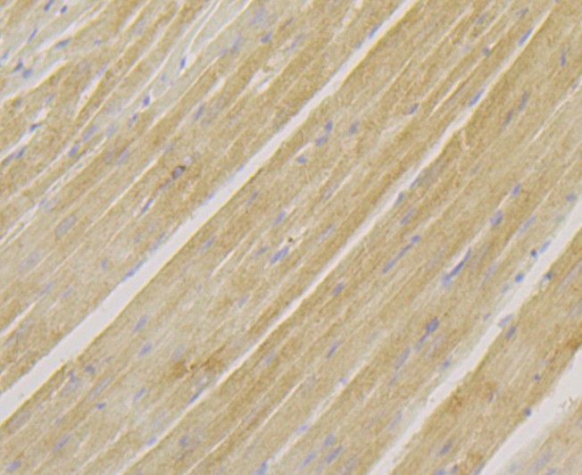 Immunohistochemical analysis of paraffin-embedded rat heart tissue using anti-Sarcomeric Alpha Actinin antibody. The section was pre-treated using heat mediated antigen retrieval with Tris-EDTA buffer (pH 8.0-8.4) for 20 minutes. The tissues were blocked in 5% BSA for 30 minutes at room temperature, washed with ddH2O and PBS, and then probed with the antibody (ET7109-42) at 1/200 dilution, for 30 minutes at room temperature and detected using an HRP conjugated compact polymer system. DAB was used as the chrogen. Counter stained with hematoxylin and mounted with DPX.