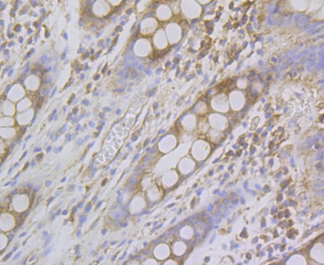 Immunohistochemical analysis of paraffin-embedded human colon tissue using anti-Sarcomeric Alpha Actinin antibody. The section was pre-treated using heat mediated antigen retrieval with Tris-EDTA buffer (pH 8.0-8.4) for 20 minutes. The tissues were blocked in 5% BSA for 30 minutes at room temperature, washed with ddH2O and PBS, and then probed with the antibody (ET7109-42) at 1/200 dilution, for 30 minutes at room temperature and detected using an HRP conjugated compact polymer system. DAB was used as the chrogen. Counter stained with hematoxylin and mounted with DPX.