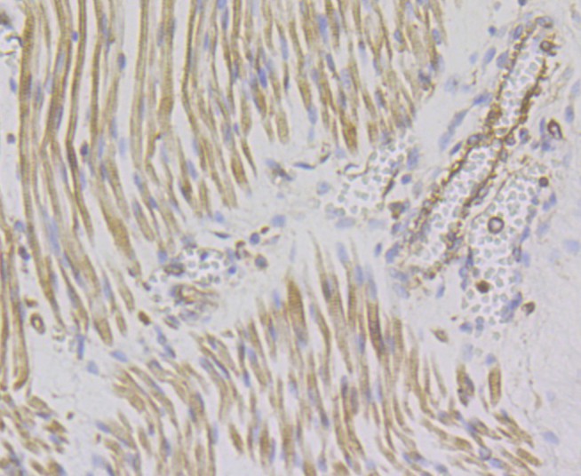 Immunohistochemical analysis of paraffin-embedded human fetal skeletal muscle tissue using anti-Sarcomeric Alpha Actinin antibody. The section was pre-treated using heat mediated antigen retrieval with Tris-EDTA buffer (pH 8.0-8.4) for 20 minutes. The tissues were blocked in 5% BSA for 30 minutes at room temperature, washed with ddH2O and PBS, and then probed with the antibody (ET7109-42) at 1/200 dilution, for 30 minutes at room temperature and detected using an HRP conjugated compact polymer system. DAB was used as the chrogen. Counter stained with hematoxylin and mounted with DPX.
