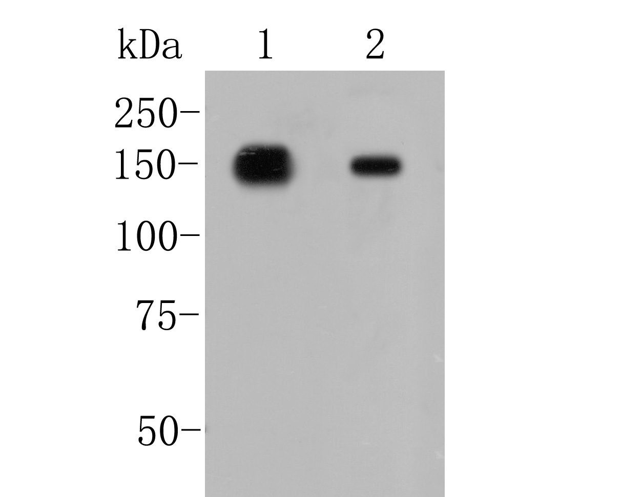 Western blot analysis of AP-A on different lysates. Proteins were transferred to a PVDF membrane and blocked with 5% BSA in PBS for 1 hour at room temperature. The primary antibody (ET7109-45, 1/500) was used in 5% BSA at room temperature for 2 hours. Goat Anti-Rabbit IgG - HRP Secondary Antibody (HA1001) at 1:5,000 dilution was used for 1 hour at room temperature.<br />
Positive control: <br />
Lane 1: Human kidney tissue lysate<br />
Lane 2: Human small intestine tissue