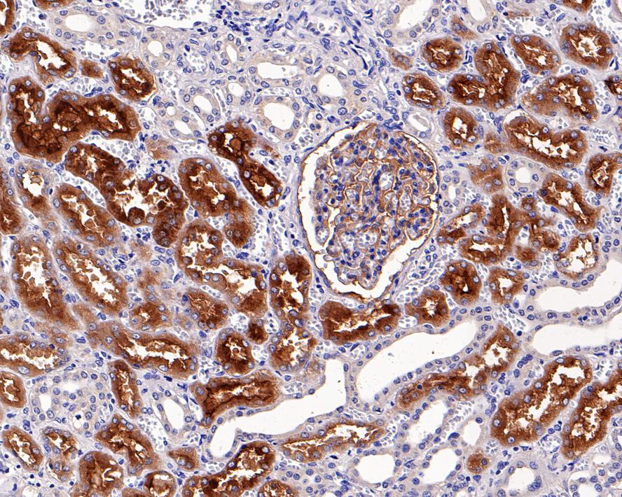 Immunohistochemical analysis of paraffin-embedded human kidney tissue using anti-AP-A antibody. The section was pre-treated using heat mediated antigen retrieval with sodium citrate buffer (pH 6.0) for 20 mins. The tissues were blocked in 5% BSA for 30 minutes at room temperature, washed with ddH2O and PBS, and then probed with the antibody (ET7109-45) at 1/200 dilution, for 30 minutes at room temperature and detected using an HRP conjugated compact polymer system. DAB was used as the chrogen. Counter stained with hematoxylin and mounted with DPX.