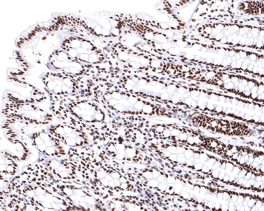 Immunohistochemical analysis of paraffin-embedded human colon tissue with Rabbit anti-RNF40 antibody (ET7109-46) at 1/400 dilution.<br />
<br />
The section was pre-treated using heat mediated antigen retrieval with sodium citrate buffer (pH 6.0) for 2 minutes. The tissues were blocked in 1% BSA for 20 minutes at room temperature, washed with ddH2O and PBS, and then probed with the primary antibody (ET7109-46) at 1/400 dilution for 1 hour at room temperature. The detection was performed using an HRP conjugated compact polymer system. DAB was used as the chromogen. Tissues were counterstained with hematoxylin and mounted with DPX.