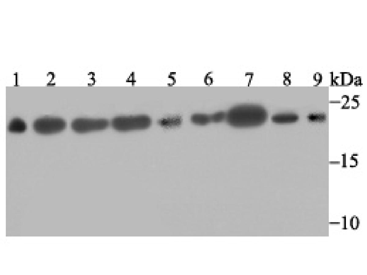 Western blot analysis of SFRS3 on different lysates. Proteins were transferred to a PVDF membrane and blocked with 5% BSA in PBS for 1 hour at room temperature. The primary antibody was used at a 1:500 dilution in 5% BSA at room temperature for 2 hours. Goat Anti-Rabbit IgG - HRP Secondary Antibody (HA1001) at 1:5,000 dilution was used for 1 hour at room temperature.<br />
Positive control:<br />
Lane 1: Mouse testis tissue lysate<br />
Lane 2: Rat brain tissue lysate<br />
Lane 3: A431 cell lysate<br />
Lane 4: SH-SY-5Y cell lysate<br />
Lane 5: SiHa cell lysate<br />
Lane 6: 293 cell lysate<br />
Lane 7: Hela cell lysate<br />
Lane 8: HepG2 cell lysate<br />
Lane 9: A549 cell lysate