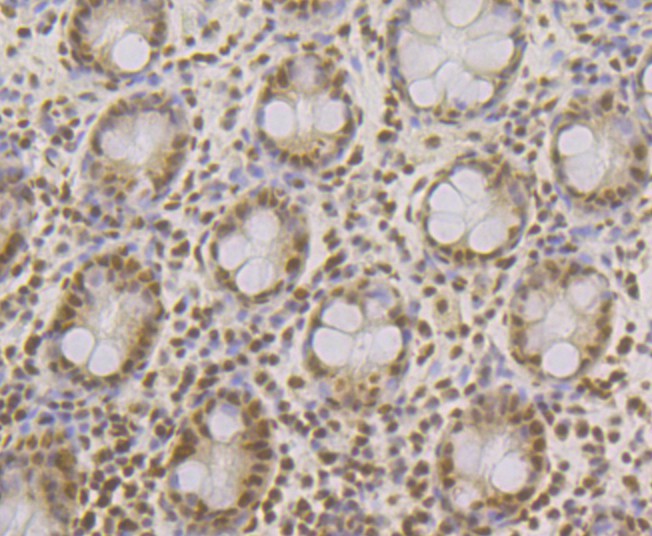 Immunohistochemical analysis of paraffin-embedded human colon tissue using anti-SFRS3 antibody. The section was pre-treated using heat mediated antigen retrieval with Tris-EDTA buffer (pH 8.0-8.4) for 20 minutes. The tissues were blocked in 5% BSA for 30 minutes at room temperature, washed with ddH2O and PBS, and then probed with the antibody (ET7109-47) at 1/200 dilution, for 30 minutes at room temperature and detected using an HRP conjugated compact polymer system. DAB was used as the chrogen. Counter stained with hematoxylin and mounted with DPX.