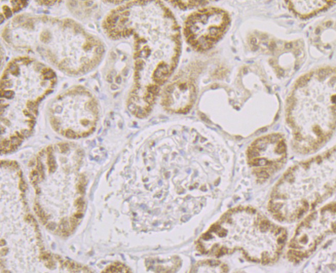 Immunohistochemical analysis of paraffin-embedded human kidney tissue using anti-SFRS3 antibody. The section was pre-treated using heat mediated antigen retrieval with Tris-EDTA buffer (pH 8.0-8.4) for 20 minutes. The tissues were blocked in 5% BSA for 30 minutes at room temperature, washed with ddH2O and PBS, and then probed with the antibody (ET7109-47) at 1/200 dilution, for 30 minutes at room temperature and detected using an HRP conjugated compact polymer system. DAB was used as the chrogen. Counter stained with hematoxylin and mounted with DPX.