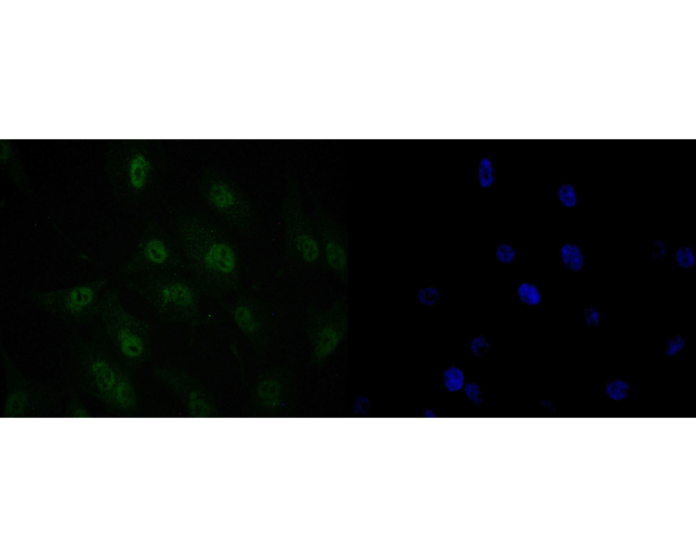 ICC staining of SFRS3 in MG-63 cells (green). Formalin fixed cells were permeabilized with 0.1% Triton X-100 in TBS for 10 minutes at room temperature and blocked with 10% negative goat serum for 15 minutes at room temperature. Cells were probed with the primary antibody (ET7109-47, 1/50) for 1 hour at room temperature, washed with PBS. Alexa Fluor®488 conjugate-Goat anti-Rabbit IgG was used as the secondary antibody at 1/1,000 dilution. The nuclear counter stain is DAPI (blue).