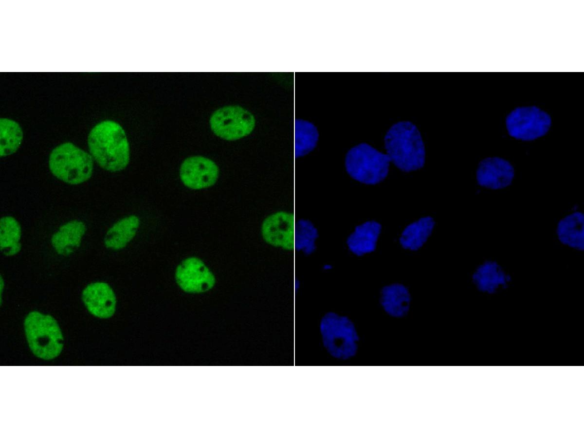 ICC staining of SAM68 in A431 cells (green). Formalin fixed cells were permeabilized with 0.1% Triton X-100 in TBS for 10 minutes at room temperature and blocked with 1% Blocker BSA for 15 minutes at room temperature. Cells were probed with the primary antibody (ET7109-52, 1/50) for 1 hour at room temperature, washed with PBS. Alexa Fluor®488 Goat anti-Rabbit IgG was used as the secondary antibody at 1/100 dilution. The nuclear counter stain is DAPI (blue).