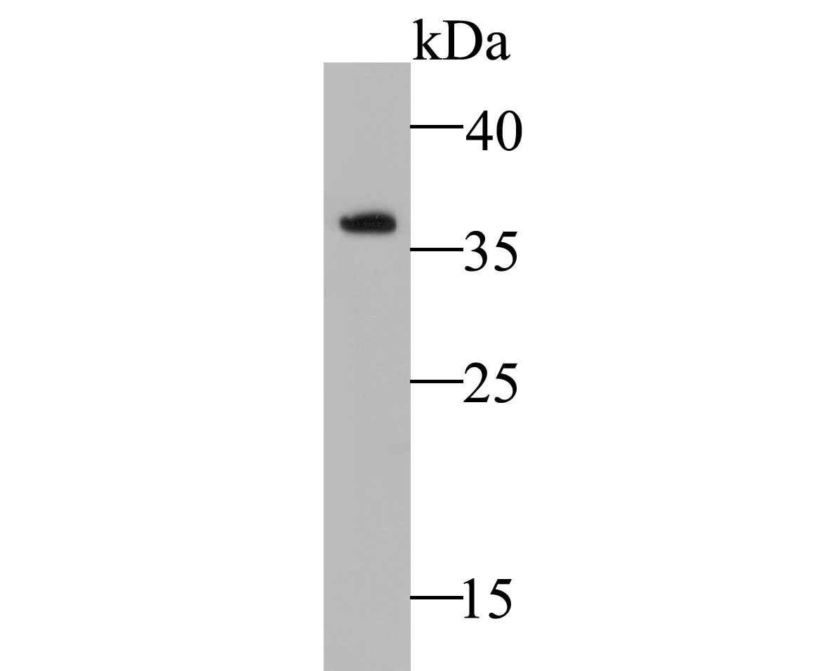 Western blot analysis of NDUFAF1 on K562 cell lysate. Proteins were transferred to a PVDF membrane and blocked with 5% BSA in PBS for 1 hour at room temperature. The primary antibody (ET7109-54, 1/1,000) was used in 5% BSA at room temperature for 2 hours. Goat Anti-Rabbit IgG - HRP Secondary Antibody (HA1001) at 1:5,000 dilution was used for 1 hour at room temperature.