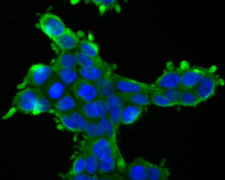 ICC staining NDUFAF1 in 293T cells (green). Formalin fixed cells were permeabilized with 0.1% Triton X-100 in TBS for 10 minutes at room temperature and blocked with 1% Blocker BSA for 15 minutes at room temperature. Cells were probed with NDUFAF1 antibody at a dilution of 1:200 for 1 hour at room temperature, washed with PBS. Alexa Fluorc™ 488 Goat anti-Rabbit IgG was used as the secondary antibody at 1/100 dilution. The nuclear counter stain is DAPI (blue).