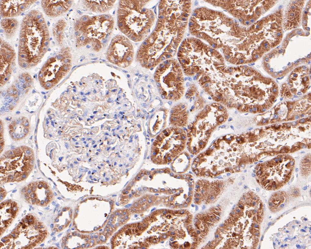 Immunohistochemical analysis of paraffin-embedded human kidney tissue using anti-NDUFAF1 antibody. The section was pre-treated using heat mediated antigen retrieval with Tris-EDTA buffer (pH 8.0-8.4) for 20 minutes. The tissues were blocked in 5% BSA for 30 minutes at room temperature, washed with ddH2O and PBS, and then probed with the antibody (ET7109-54) at 1/200 dilution, for 30 minutes at room temperature and detected using an HRP conjugated compact polymer system. DAB was used as the chrogen. Counter stained with hematoxylin and mounted with DPX.