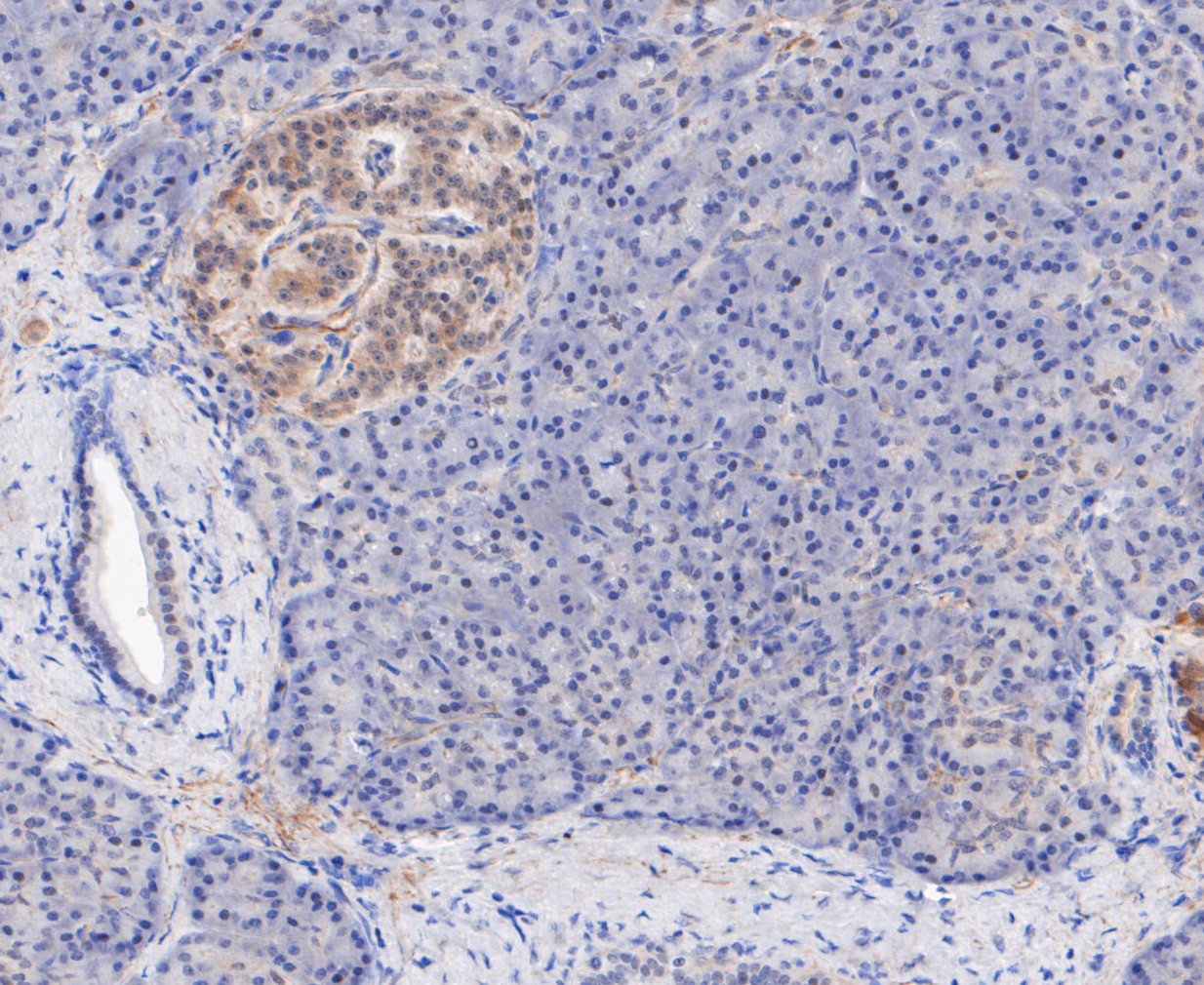 Immunohistochemical analysis of paraffin-embedded human pancreas tissue using anti-TPPP antibody. The section was pre-treated using heat mediated antigen retrieval with sodium citrate buffer (pH 6.0) for 20 minutes. The tissues were blocked in 5% BSA for 30 minutes at room temperature, washed with ddH2O and PBS, and then probed with the primary antibody (ET7109-56, 1/50)  for 30 minutes at room temperature. The detection was performed using an HRP conjugated compact polymer system. DAB was used as the chromogen. Tissues were counterstained with hematoxylin and mounted with DPX.