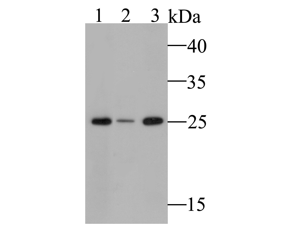 Western blot analysis of GSTK1 on different lysates. Proteins were transferred to a PVDF membrane and blocked with 5% BSA in PBS for 1 hour at room temperature. The primary antibody (ET7109-58, 1/1,000) was used in 5% BSA at room temperature for 2 hours. Goat Anti-Rabbit IgG - HRP Secondary Antibody (HA1001) at 1:5,000 dilution was used for 1 hour at room temperature.<br />
Positive control: <br />
Lane 1: SK-BR-3 cell lysate<br />
Lane 2: Human skin tissue lysate<br />
Lane 3: Human placenta tissue lysate