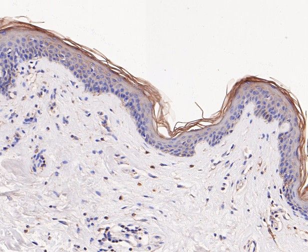 Immunohistochemical analysis of paraffin-embedded human skin tissue using anti-GSTK1 antibody. The section was pre-treated using heat mediated antigen retrieval with Tris-EDTA buffer (pH 8.0-8.4) for 20 minutes.The tissues were blocked in 5% BSA for 30 minutes at room temperature, washed with ddH2O and PBS, and then probed with the primary antibody (ET7109-58, 1/50) for 30 minutes at room temperature. The detection was performed using an HRP conjugated compact polymer system. DAB was used as the chromogen. Tissues were counterstained with hematoxylin and mounted with DPX.