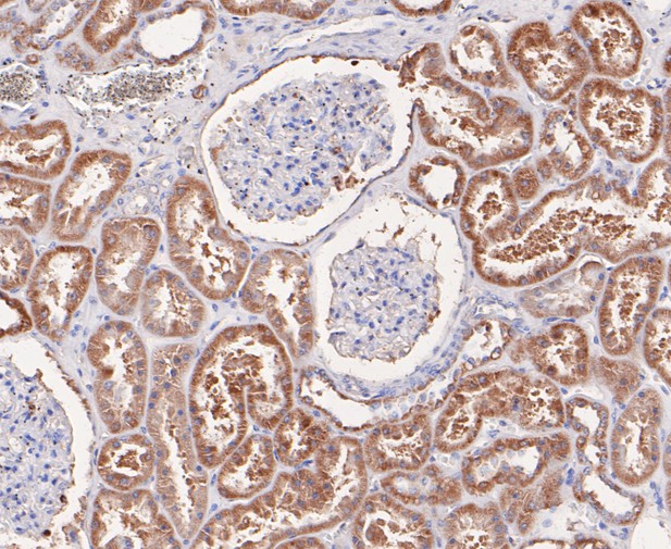 Immunohistochemical analysis of paraffin-embedded human kidney tissue using anti-GSTK1 antibody. The section was pre-treated using heat mediated antigen retrieval with Tris-EDTA buffer (pH 8.0-8.4) for 20 minutes.The tissues were blocked in 5% BSA for 30 minutes at room temperature, washed with ddH2O and PBS, and then probed with the primary antibody (ET7109-58, 1/50) for 30 minutes at room temperature. The detection was performed using an HRP conjugated compact polymer system. DAB was used as the chromogen. Tissues were counterstained with hematoxylin and mounted with DPX.