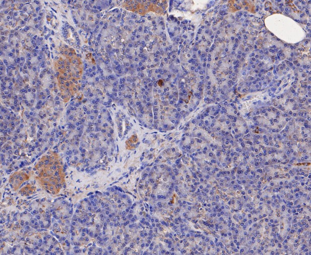 Immunohistochemical analysis of paraffin-embedded human pancreas tissue using anti-GSTK1 antibody. The section was pre-treated using heat mediated antigen retrieval with Tris-EDTA buffer (pH 8.0-8.4) for 20 minutes.The tissues were blocked in 5% BSA for 30 minutes at room temperature, washed with ddH2O and PBS, and then probed with the primary antibody (ET7109-58, 1/50) for 30 minutes at room temperature. The detection was performed using an HRP conjugated compact polymer system. DAB was used as the chromogen. Tissues were counterstained with hematoxylin and mounted with DPX.