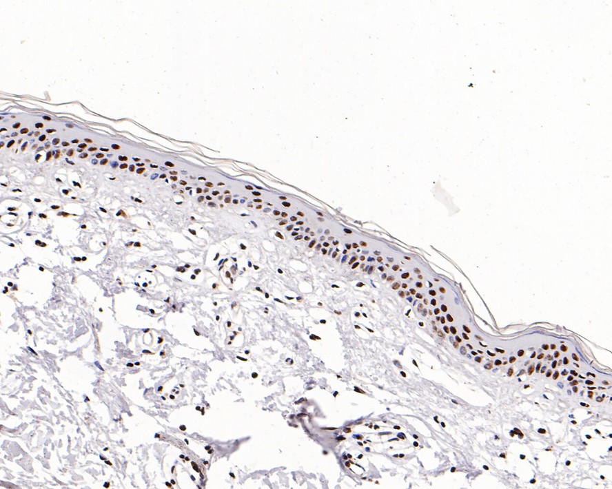 Immunohistochemical analysis of paraffin-embedded human skin tissue with Rabbit anti-GTPBP4 antibody (ET7109-59) at 1/500 dilution.<br />
<br />
The section was pre-treated using heat mediated antigen retrieval with sodium citrate buffer (pH 6.0) for 2 minutes. The tissues were blocked in 1% BSA for 20 minutes at room temperature, washed with ddH2O and PBS, and then probed with the primary antibody (ET7109-59) at 1/500 dilution for 1 hour at room temperature. The detection was performed using an HRP conjugated compact polymer system. DAB was used as the chromogen. Tissues were counterstained with hematoxylin and mounted with DPX.
