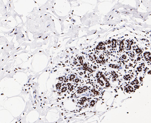 Immunohistochemical analysis of paraffin-embedded human breast tissue using anti-GTPBP4 antibody. The section was pre-treated using heat mediated antigen retrieval with sodium citrate buffer (pH 6.0) for 20 minutes. The tissues were blocked in 5% BSA for 30 minutes at room temperature, washed with ddH2O and PBS, and then probed with the primary antibody (ET7109-59, 1/50)  for 30 minutes at room temperature. The detection was performed using an HRP conjugated compact polymer system. DAB was used as the chromogen. Tissues were counterstained with hematoxylin and mounted with DPX.