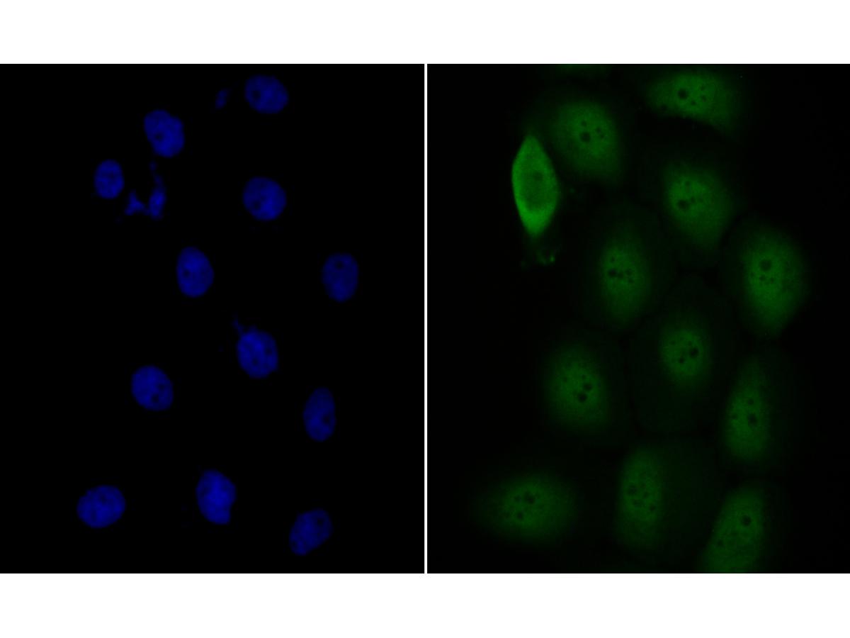 ICC staining of COPS3/CSN3 in A431 cells (green). Formalin fixed cells were permeabilized with 0.1% Triton X-100 in TBS for 10 minutes at room temperature and blocked with 1% Blocker BSA for 15 minutes at room temperature. Cells were probed with the primary antibody (ET7109-60, 1/500) for 1 hour at room temperature, washed with PBS. Alexa Fluor®488 Goat anti-Rabbit IgG was used as the secondary antibody at 1/100 dilution. The nuclear counter stain is DAPI (blue).