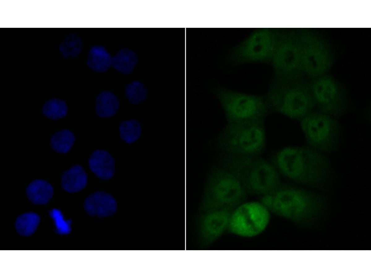 ICC staining of COPS3/CSN3 in HCT116 cells (green). Formalin fixed cells were permeabilized with 0.1% Triton X-100 in TBS for 10 minutes at room temperature and blocked with 1% Blocker BSA for 15 minutes at room temperature. Cells were probed with the primary antibody (ET7109-60, 1/500) for 1 hour at room temperature, washed with PBS. Alexa Fluor®488 Goat anti-Rabbit IgG was used as the secondary antibody at 1/100 dilution. The nuclear counter stain is DAPI (blue).