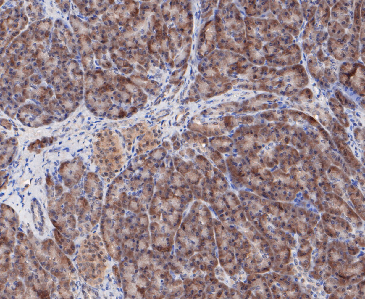 Immunohistochemical analysis of paraffin-embedded human pancreas tissue using anti-COPS3/CSN3 antibody. The section was pre-treated using heat mediated antigen retrieval with sodium citrate buffer (pH 6.0) for 20 minutes. The tissues were blocked in 5% BSA for 30 minutes at room temperature, washed with ddH2O and PBS, and then probed with the primary antibody (ET7109-60, 1/50)  for 30 minutes at room temperature. The detection was performed using an HRP conjugated compact polymer system. DAB was used as the chromogen. Tissues were counterstained with hematoxylin and mounted with DPX.