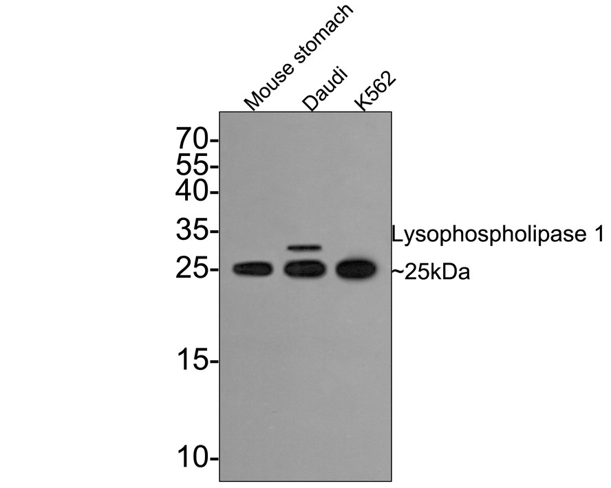 Western blot analysis of Lysophospholipase 1 on different lysates with Rabbit anti-Lysophospholipase 1 antibody (ET7109-63) at 1/500 dilution.<br />
<br />
Lane 1: Mouse stomach tissue lysate (20 µg/Lane)<br />
Lane 2: Daudi cell lysate<br />
Lane 3: K562 cell lysate<br />
<br />
Lysates/proteins at 10 µg/Lane.<br />
<br />
Predicted band size: 25 kDa<br />
Observed band size: 25/30 kDa<br />
<br />
Exposure time: 2 minutes;<br />
<br />
15% SDS-PAGE gel.<br />
<br />
Proteins were transferred to a PVDF membrane and blocked with 5% NFDM/TBST for 1 hour at room temperature. The primary antibody (ET7109-63) at 1/500 dilution was used in 5% NFDM/TBST at room temperature for 2 hours. Goat Anti-Rabbit IgG - HRP Secondary Antibody (HA1001) at 1:200,000 dilution was used for 1 hour at room temperature.