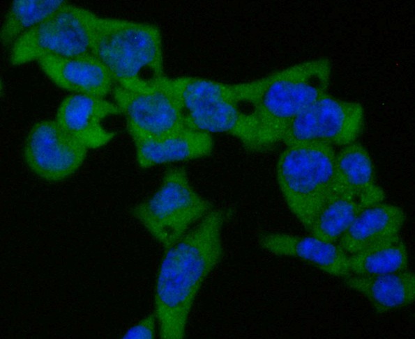 ICC staining of Lysophospholipase 1 in F9 cells (green). Formalin fixed cells were permeabilized with 0.1% Triton X-100 in TBS for 10 minutes at room temperature and blocked with 1% Blocker BSA for 15 minutes at room temperature. Cells were probed with the primary antibody (ET7109-63, 1/50) for 1 hour at room temperature, washed with PBS. Alexa Fluor®488 Goat anti-Rabbit IgG was used as the secondary antibody at 1/100 dilution. The nuclear counter stain is DAPI (blue).