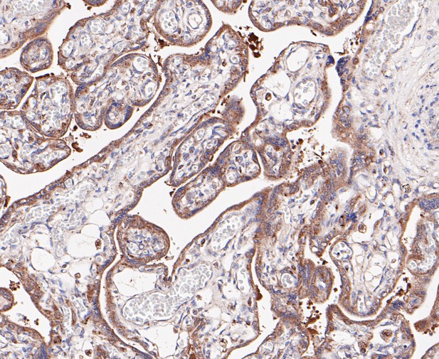 Immunohistochemical analysis of paraffin-embedded human placenta tissue using anti-Lysophospholipase 1 antibody. The section was pre-treated using heat mediated antigen retrieval with Tris-EDTA buffer (pH 8.0-8.4) for 20 minutes.The tissues were blocked in 5% BSA for 30 minutes at room temperature, washed with ddH2O and PBS, and then probed with the primary antibody (ET7109-63, 1/200) for 30 minutes at room temperature. The detection was performed using an HRP conjugated compact polymer system. DAB was used as the chromogen. Tissues were counterstained with hematoxylin and mounted with DPX.