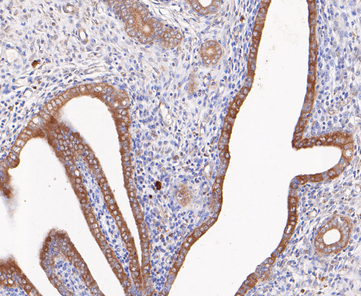 Immunohistochemical analysis of paraffin-embedded rat uterus tissue using anti-Calpain small subunit 1 antibody. The section was pre-treated using heat mediated antigen retrieval with Tris-EDTA buffer (pH 8.0-8.4) for 20 minutes.The tissues were blocked in 5% BSA for 30 minutes at room temperature, washed with ddH2O and PBS, and then probed with the primary antibody (ET7109-66, 1/200) for 30 minutes at room temperature. The detection was performed using an HRP conjugated compact polymer system. DAB was used as the chromogen. Tissues were counterstained with hematoxylin and mounted with DPX.