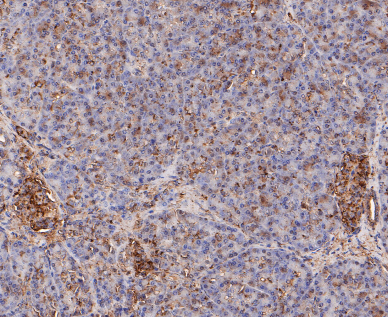 Immunohistochemical analysis of paraffin-embedded human pancreas tissue using anti-Calpain small subunit 1 antibody. The section was pre-treated using heat mediated antigen retrieval with Tris-EDTA buffer (pH 8.0-8.4) for 20 minutes.The tissues were blocked in 5% BSA for 30 minutes at room temperature, washed with ddH2O and PBS, and then probed with the primary antibody (ET7109-66, 1/50) for 30 minutes at room temperature. The detection was performed using an HRP conjugated compact polymer system. DAB was used as the chromogen. Tissues were counterstained with hematoxylin and mounted with DPX.