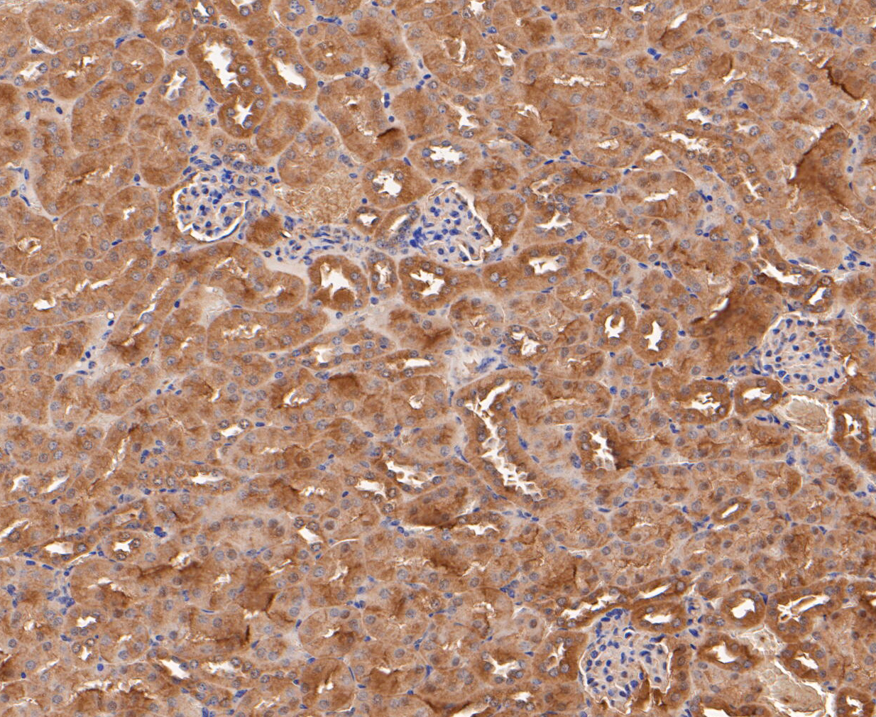 Immunohistochemical analysis of paraffin-embedded mouse kidney tissue using anti-Calpain small subunit 1 antibody. The section was pre-treated using heat mediated antigen retrieval with Tris-EDTA buffer (pH 8.0-8.4) for 20 minutes.The tissues were blocked in 5% BSA for 30 minutes at room temperature, washed with ddH2O and PBS, and then probed with the primary antibody (ET7109-66, 1/50) for 30 minutes at room temperature. The detection was performed using an HRP conjugated compact polymer system. DAB was used as the chromogen. Tissues were counterstained with hematoxylin and mounted with DPX.